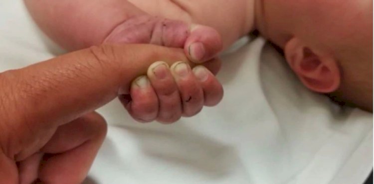 Israel: नवजात के पेट में पल रहे थे 2 Twin Baby, ऐसे हुआ खुलासा